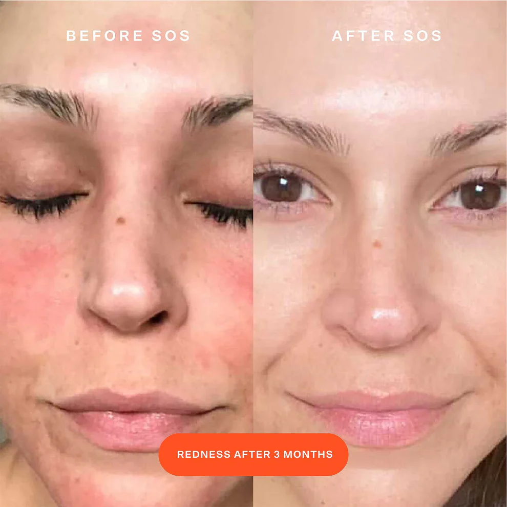 SOS Daily Rescue Facial Spray - الصورة 5