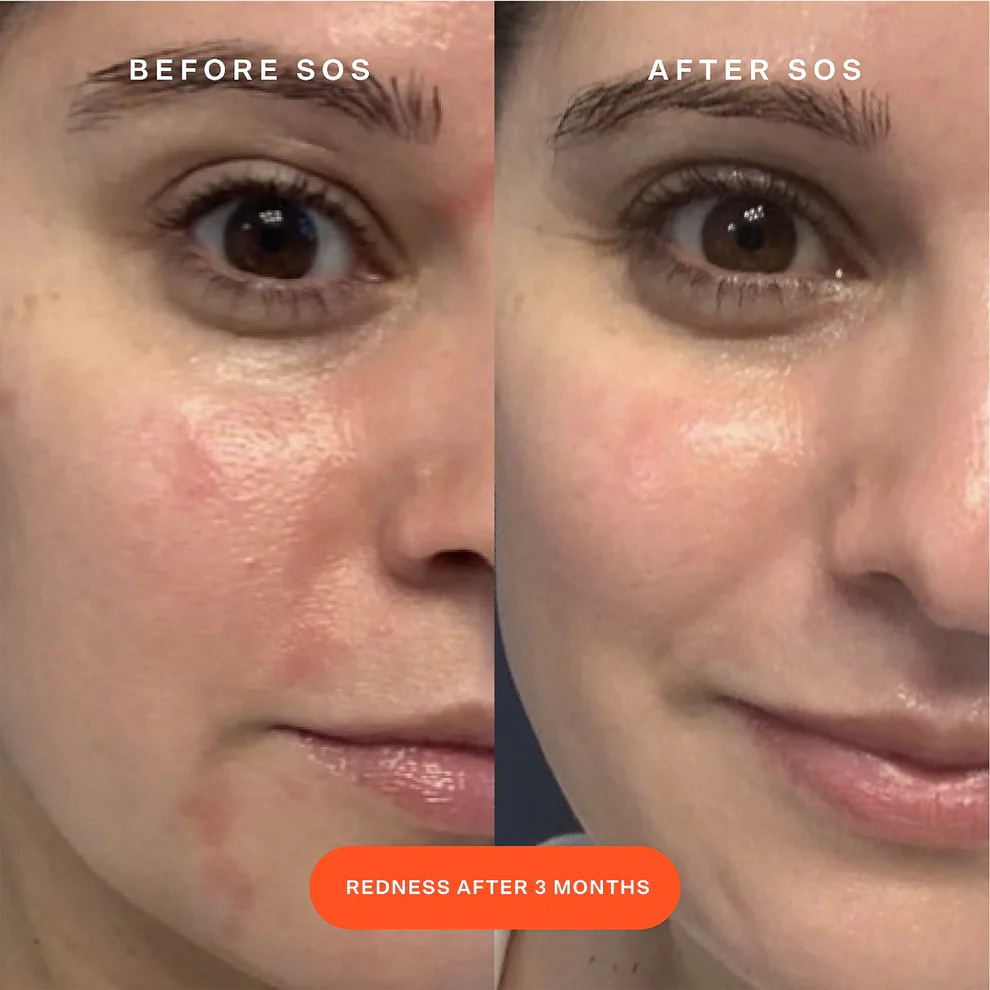 SOS Daily Rescue Facial Spray - الصورة 3